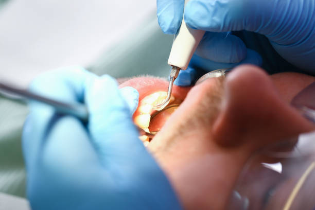 Best Emergency Orthodontic Repairs in Marlette, MI